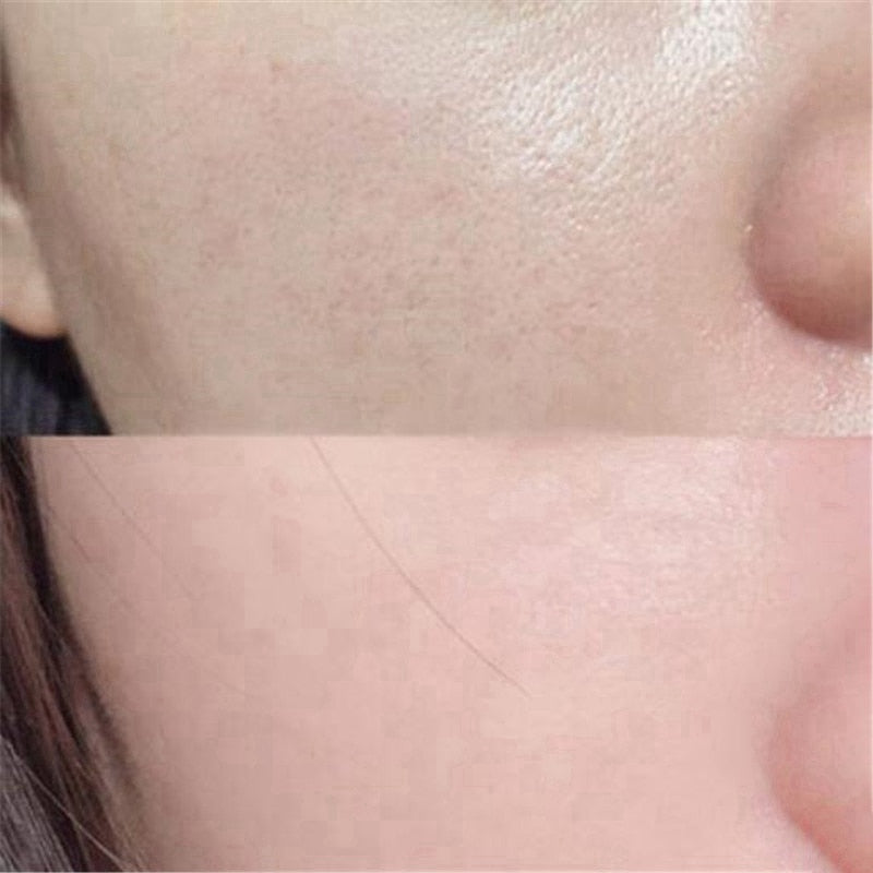 Pore Refining Serum