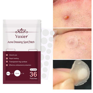 Skin Care Tools Acne Dressing Spot Patch